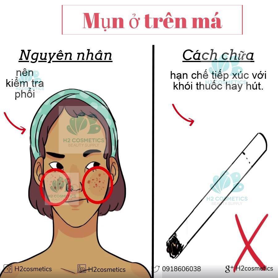 shop thanakha hưỡng dẫn trị mụn